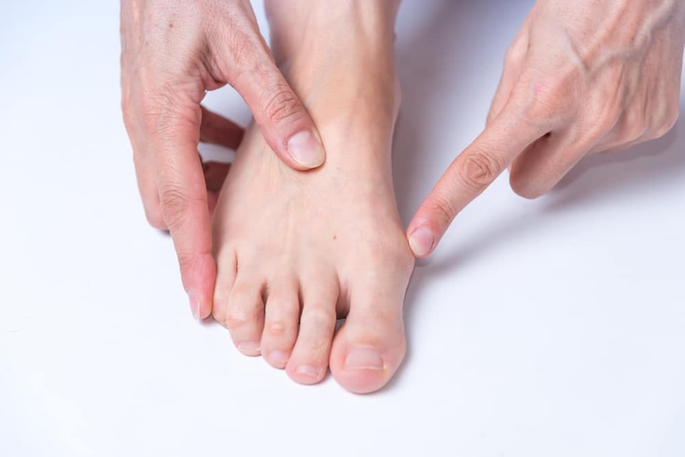 Bunion On Foot Arthritis Health Body Medicine Close Up